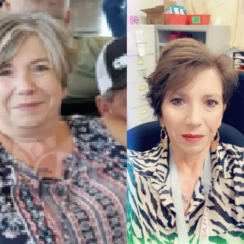 Linda B - 1 Year Update*